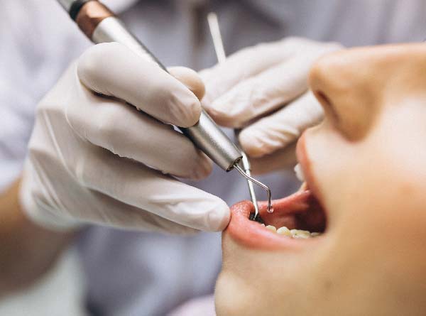 Colocação do Aparelho Dentário Colocação do Aparelho Dentário